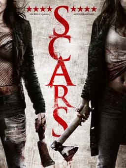 Scars