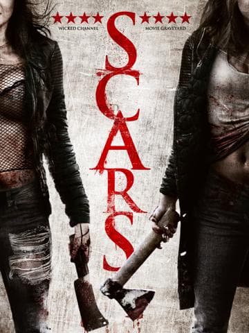 Scars