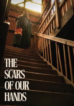 The Scars of Our Hands