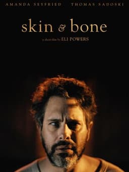 Skin & Bone